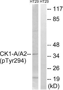 Western blot analysis of lysates from HT29 cells treated with heat shock using Anti-CK-1 alpha (phospho Tyr294) Antibody The right hand lane represents a negative control, where the antibody is blocked by the immunising peptide