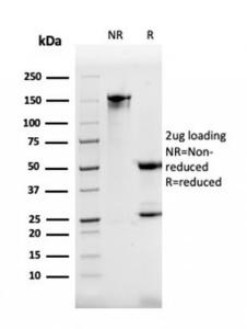 SDS-PAGE analysis of Anti-DBC2 Antibody [DBC2/3362] under non-reduced and reduced conditions; showing intact IgG and intact heavy and light chains, respectively SDS-PAGE analysis confirms the integrity and purity of the antibody