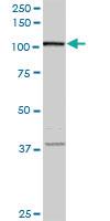 Anti-CCDC132 Mouse Monoclonal Antibody [clone: 2D11]