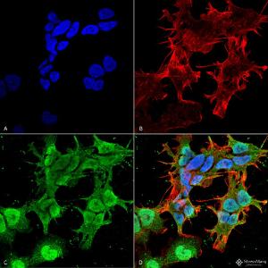 Immunocytochemistry/Immunofluorescence analysis of human neuroblastoma cell line (SK-N-BE, fixed in 4% formaldehyde for 15  min at room temperature, using Anti-Stargazin Antibody [S245-36] (A304819), at 1:100 for 60  minutes at room temperature