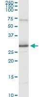 Anti-PRDX3 Antibody Pair