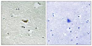 Immunohistochemical analysis of paraffin-embedded human brain using Anti-CK-1 alpha (phospho Tyr294) Antibody The right hand panel represents a negative control, where the antibody was pre-incubated with the immunising peptide