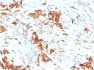 Anti-Mesothelin Mouse Monoclonal Antibody [clone: MSLN/3385]