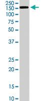 Anti-PTPRT Goat Polyclonal Antibody