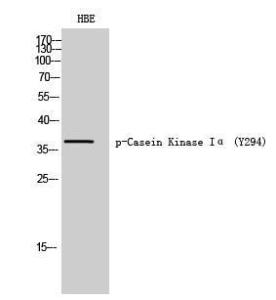 Western blot analysis of HBE cells using Anti-CK-1 alpha (phospho Tyr294) Antibody