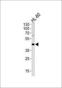 Anti-ADA Rabbit Polyclonal Antibody (HRP (Horseradish Peroxidase))