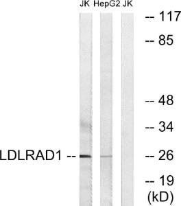 Western blot analysis of lysates from Jurkat and HepG2 cells using Anti-LDLRAD1 Antibody. The right hand lane represents a negative control, where the antibody is blocked by the immunising peptide.