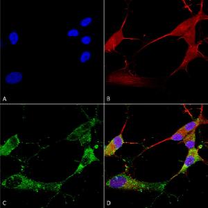 Immunocytochemistry/Immunofluorescence analysis of human neuroblastoma cells (SH-SY5Y), fixed in 4% PFA for 15  min, using Anti-Stargazin Antibody [S245-36] (A304819), at 1:100 for overnight at 4 °C with slow rocking.