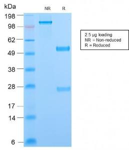 SDS-PAGE analysis of Anti-Phosphotyrosine Antibody [PY2870R] under non-reduced and reduced conditions; showing intact IgG and intact heavy and light chains, respectively. SDS-PAGE analysis confirms the integrity and purity of the antibody