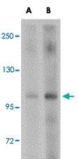 Anti-KDM4A Rabbit Polyclonal Antibody