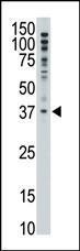 Anti-MAGEF1 Rabbit Polyclonal Antibody (AP (Alkaline Phosphatase))