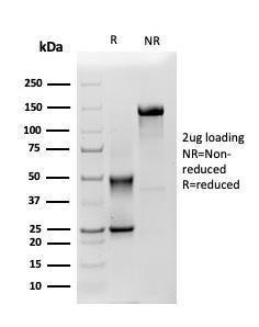 Anti-Mesothelin Mouse Monoclonal Antibody [clone: MSLN/3385]