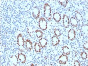 Anti-MSH6 antibody