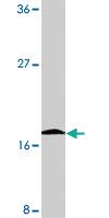 Anti-BIRC5 Rabbit Polyclonal Antibody