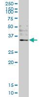 Anti-OTUB Mouse Monoclonal Antibody [clone: 1C12]