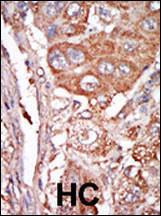 Anti-FGF4 Rabbit Polyclonal Antibody (AP (Alkaline Phosphatase))