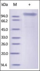 The purity of rh COMP was determined by DTT-reduced (+) SDS-PAGE and staining overnight with Coomassie Blue.