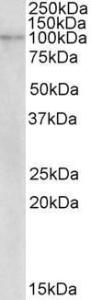 Anti-NLRX1 Antibody (A82771) (2 µg/ml) staining of Human Breast cancer lysate (35 µg protein in RIPA buffer). Primary incubation was 1 hour. Detected by chemiluminescence