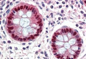 Anti-EGR2 Antibody (A84367) (3.8 µg/ml) staining of paraffin embedded Human Colon. Steamed antigen retrieval with citrate buffer pH 6, AP-staining