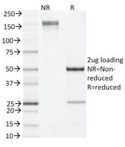 SDS-PAGE analysis of Anti-IL-4 Antibody [11B11] under non-reduced and reduced conditions; showing intact IgG and intact heavy and light chains, respectively SDS-PAGE analysis confirms the integrity and purity of the antibody