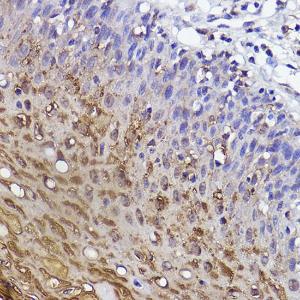 Immunohistochemistry analysis of paraffin-embedded human cervical tissue using Anti-SerpinB3 / SCCA Antibody [ARC2508] (A308934) at a dilution of 1:100 (40x lens)