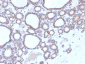 Immunohistochemical analysis of formalin-fixed, paraffin-embedded human thyroid using Anti-DBC2 Antibody [DBC2/3364]