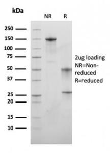 Anti-MSH6 antibody