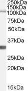 Anti-Ide Antibody (A84368) (1 µg/ml) staining of Mouse Brain lysate (35 µg protein in RIPA buffer). Primary incubation was 1 hour. Detected by chemilu minescence