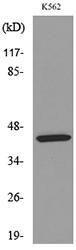 Western blot analysis of lysate from K562 cells using Anti-KIR3DL3 Antibody