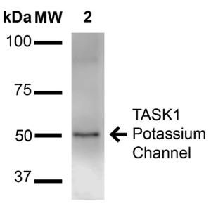 Western blot analysis of rat brain membrane showing detection of ~50 kDa TASK1 Potassium Channel protein using Anti-KCNK3 Antibody [S374-48] (A304820) at 1:1,000 for 16 hours at 4°