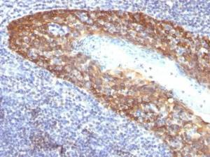 Immunohistochemical analysis of formalin-fixed, paraffin-embedded human tonsil using Anti-Cytokeratin 14 Antibody [KRT14/532]