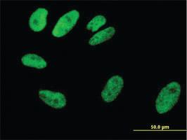 Anti-SRF Mouse Monoclonal Antibody [clone: 2G2]