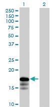 Anti-RNF181 Mouse Polyclonal Antibody