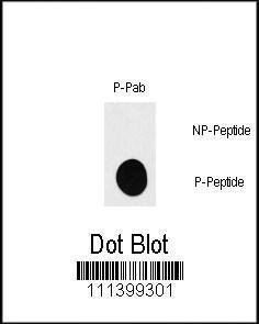 Anti-RPS6KB1 Rabbit Polyclonal Antibody (Biotin)