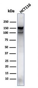 Anti-MSH6 antibody