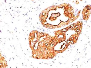 Anti-MUC1 Mouse Monoclonal Antibody [clone: 139H2]