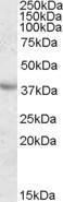 Anti-APOA5 antibody