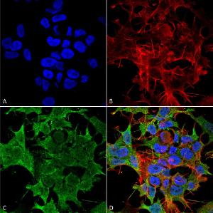 Immunocytochemistry/Immunofluorescence analysis of human neuroblastoma cell line (SK-N-BE, fixed in 4% formaldehyde for 15 min at room temperature, using Anti-KCNK3 Antibody [S374-48] (A304820), at 1:100 for 60 minutes at room temperatur