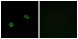 Anti-GPR116 antibody