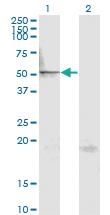 Anti-MAPK8 Mouse Monoclonal Antibody [clone: 1E1]