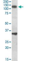 Anti-CCAR1 Goat Polyclonal Antibody