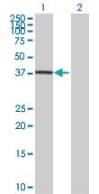 Anti-RNF34 Mouse Polyclonal Antibody