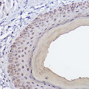 Immunohistochemistry analysis of paraffin-embedded mouse skin using Anti-SerpinB3 / SCCA Antibody [ARC2508] (A308934) at a dilution of 1:100 (40x lens)