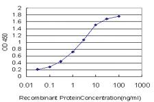 Anti-SRF Mouse Monoclonal Antibody [clone: 2G2]