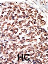 Anti-PRKD3 Rabbit Polyclonal Antibody (AP (Alkaline Phosphatase))