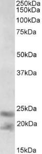 Anti-IL25 Antibody (A82773) (0.3µg/ml) staining of Human Prostate lysate (35µg protein in RIPA buffer). Primary incubation was 1 hour. Detected by chemiluminescence.