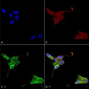 Anti-TRPM7 Mouse Monoclonal Antibody [clone: S74]