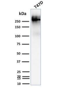 Anti-MUC1 Mouse Monoclonal Antibody [clone: 139H2]