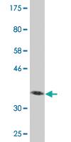 Anti-VPS16 Mouse Monoclonal Antibody [clone: 2F10]