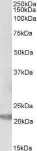 Anti-IL25 Antibody (A82774) (0.5µg/ml) staining of Human Prostate lysate (35µg protein in RIPA buffer). Primary incubation was 1 hour. Detected by chemiluminescence.